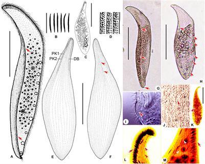 Species Diversity of the Pleurostomatid Ciliate Genus Amphileptus (Ciliophora, Haptoria), With Notes on the Taxonomy and Molecular Phylogeny of Three Species